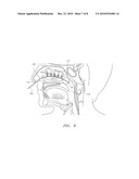 DEVICES FOR COOLING THE NASAL CAVITY diagram and image