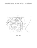 DEVICES FOR COOLING THE NASAL CAVITY diagram and image