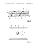  DEVICE FOR TREATMENT OF WOUNDS WITH REDUCED PRESSURE diagram and image