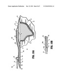 Apparatus for Vacuum Bridging and/or Exudate Collection diagram and image