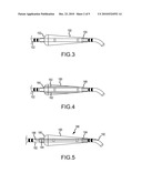 Methods and systems for occluding vessels during cardiac ablation incuding optional electroanatomical guidance diagram and image