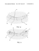 Methods and systems for occluding vessels during cardiac ablation incuding optional electroanatomical guidance diagram and image