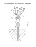 SYSTEMS AND METHODS FOR ELECTROSURGICAL INTERVERTEBRAL DISC REPLACEMENT diagram and image