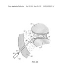 SYSTEMS AND METHODS FOR ELECTROSURGICAL INTERVERTEBRAL DISC REPLACEMENT diagram and image