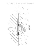 SYSTEMS AND METHODS FOR ELECTROSURGICAL INTERVERTEBRAL DISC REPLACEMENT diagram and image