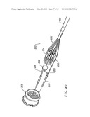 SYSTEMS AND METHODS FOR ELECTROSURGICAL INTERVERTEBRAL DISC REPLACEMENT diagram and image