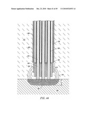 SYSTEMS AND METHODS FOR ELECTROSURGICAL INTERVERTEBRAL DISC REPLACEMENT diagram and image