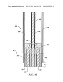 SYSTEMS AND METHODS FOR ELECTROSURGICAL INTERVERTEBRAL DISC REPLACEMENT diagram and image