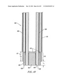 SYSTEMS AND METHODS FOR ELECTROSURGICAL INTERVERTEBRAL DISC REPLACEMENT diagram and image