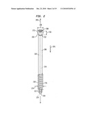 Fixation system, an intramedullary fixation assembly and method of use diagram and image