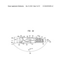 Fixation system, an intramedullary fixation assembly and method of use diagram and image