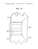 Fixation system, an intramedullary fixation assembly and method of use diagram and image