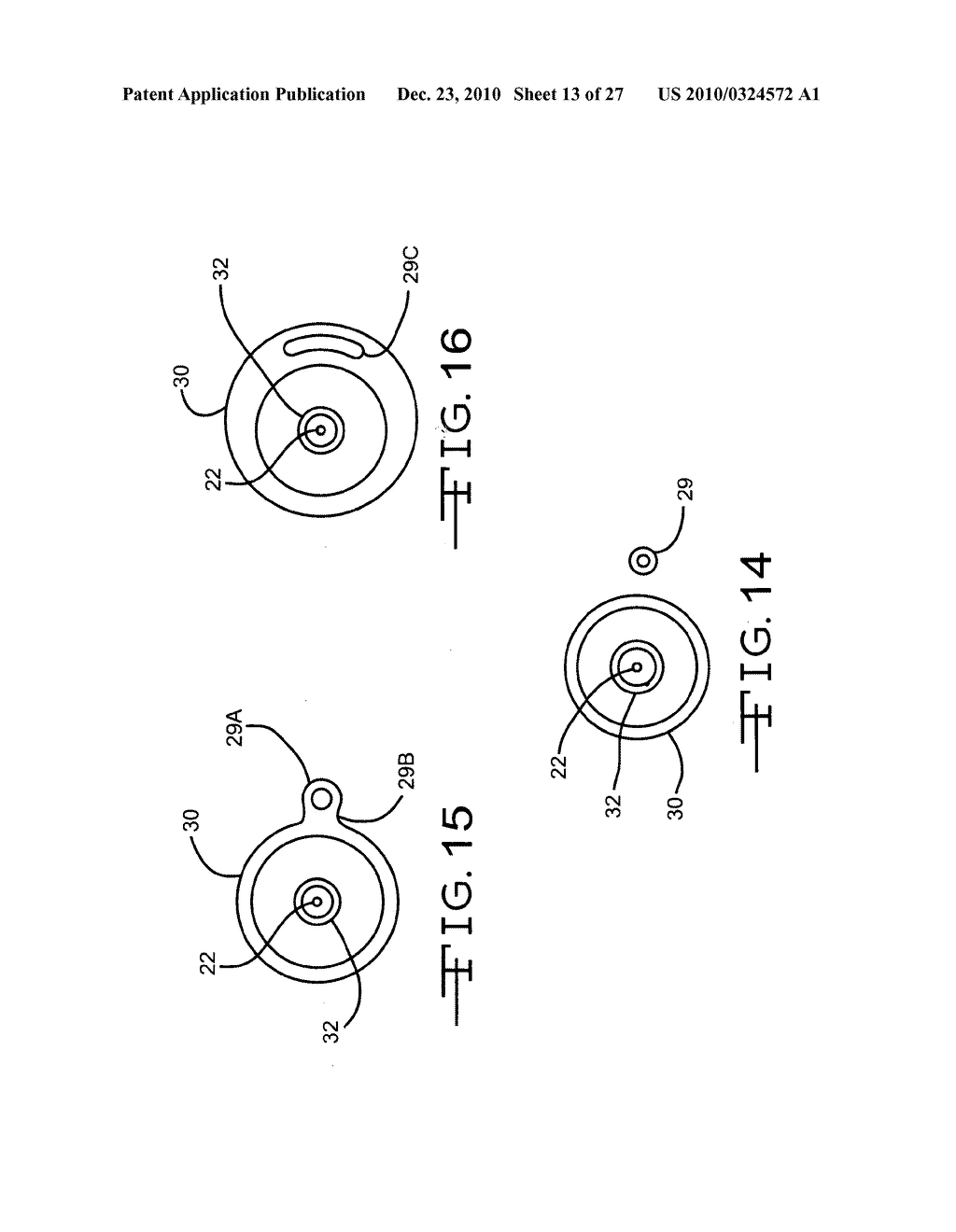 Endolumenal Restriction Method and Apparatus - diagram, schematic, and image 14