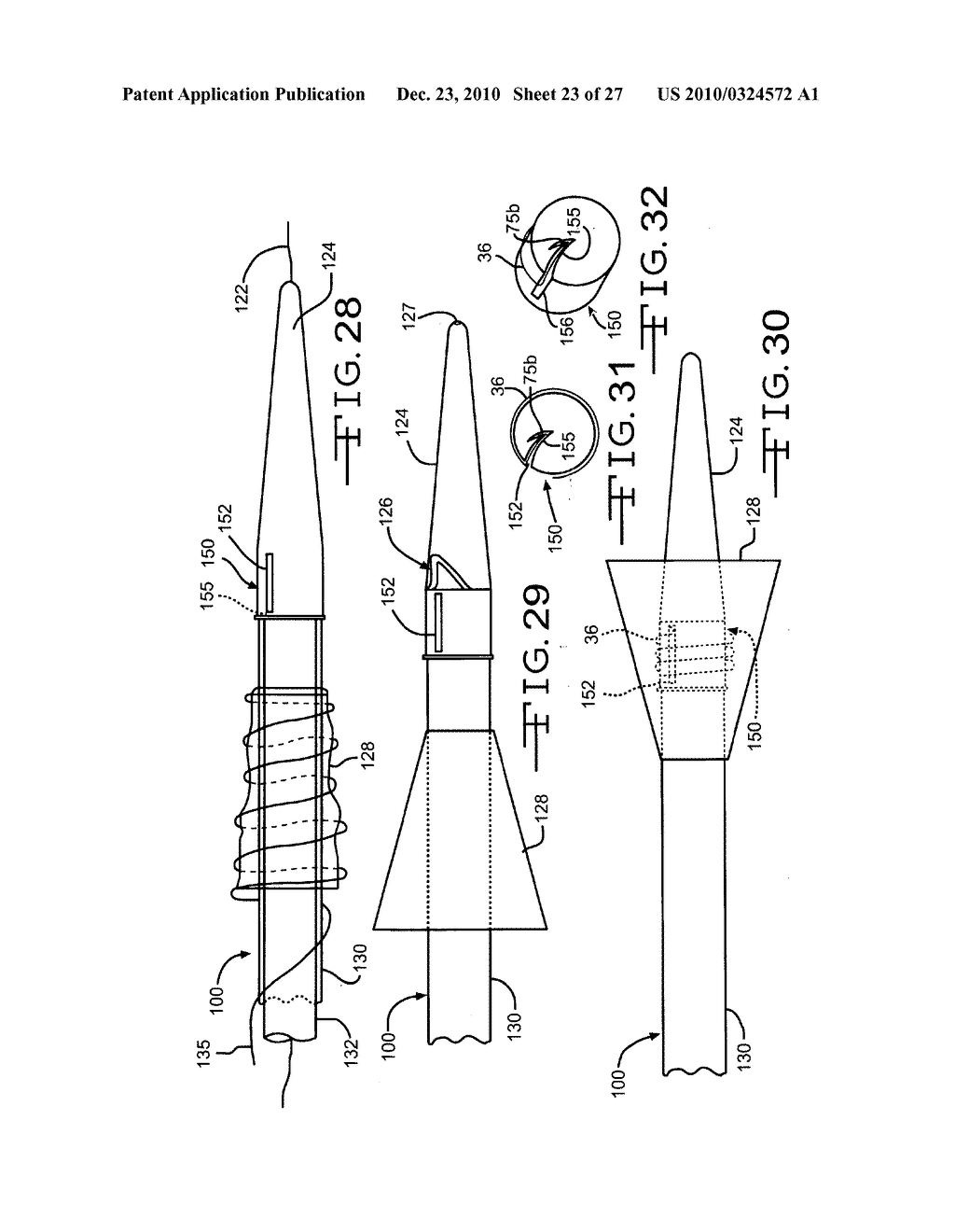 Endolumenal Restriction Method and Apparatus - diagram, schematic, and image 24