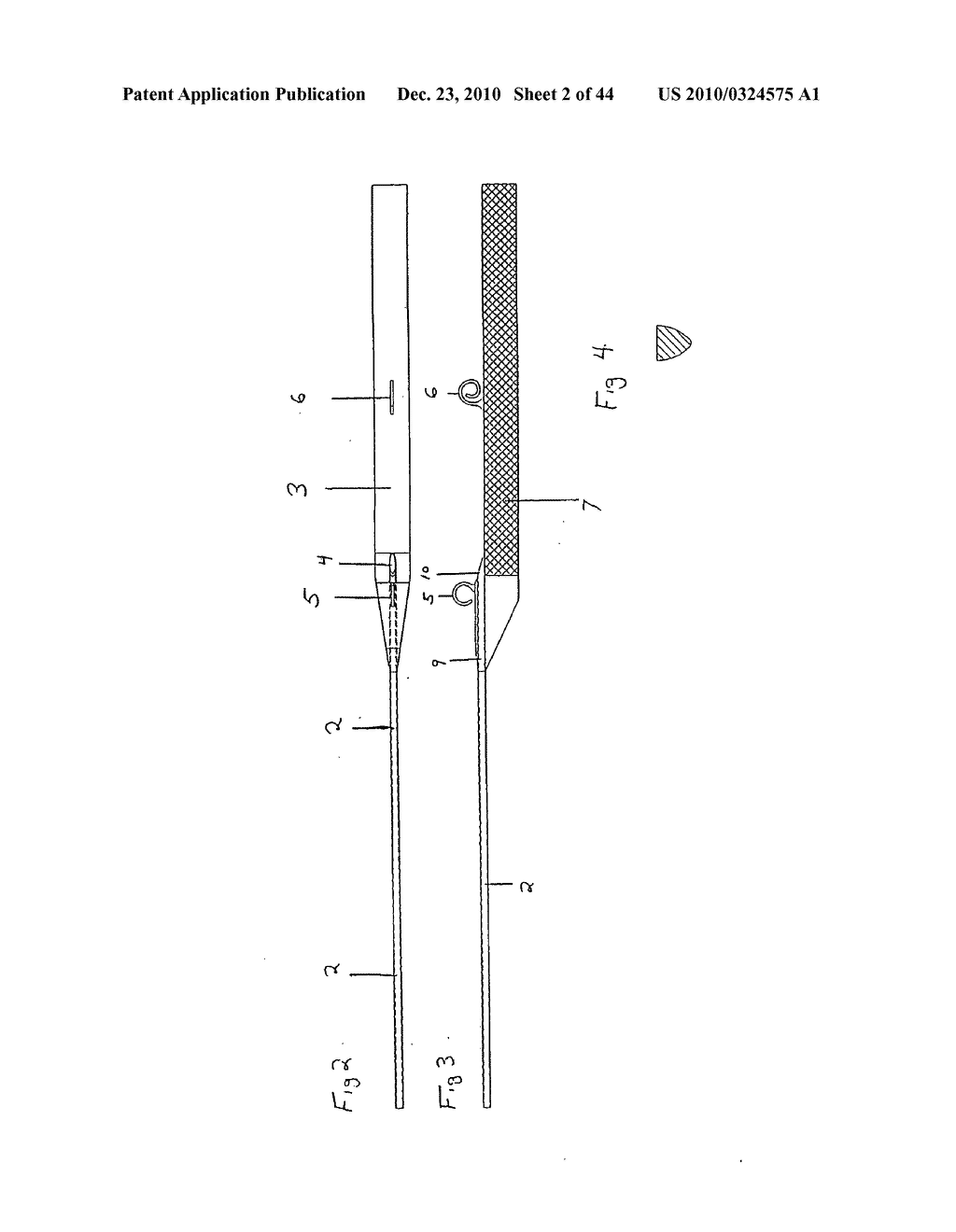 SURGICAL REPAIR KIT AND ITS METHOD OF USE - diagram, schematic, and image 03