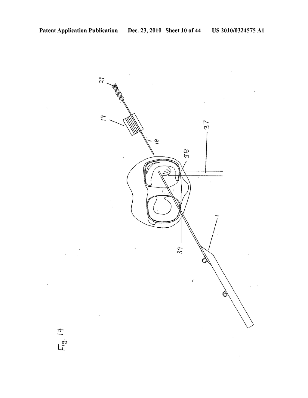 SURGICAL REPAIR KIT AND ITS METHOD OF USE - diagram, schematic, and image 11