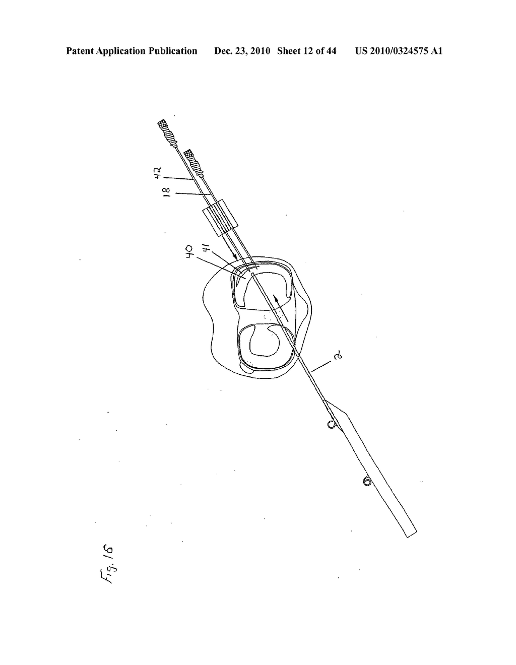 SURGICAL REPAIR KIT AND ITS METHOD OF USE - diagram, schematic, and image 13