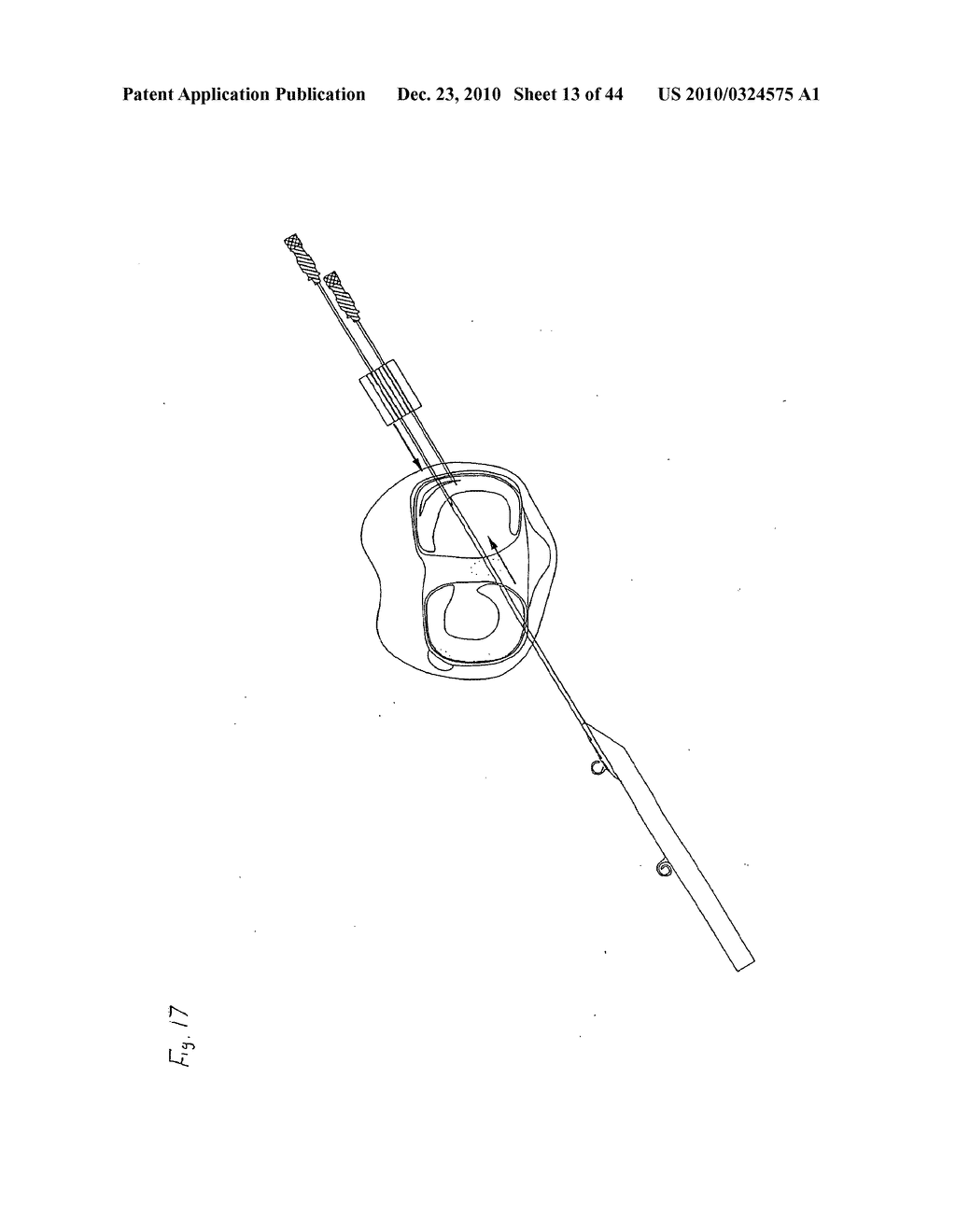 SURGICAL REPAIR KIT AND ITS METHOD OF USE - diagram, schematic, and image 14