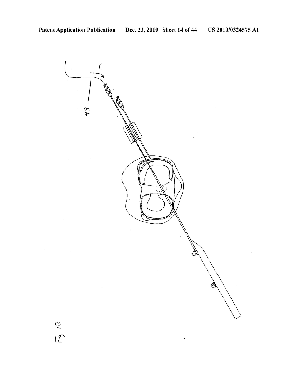 SURGICAL REPAIR KIT AND ITS METHOD OF USE - diagram, schematic, and image 15