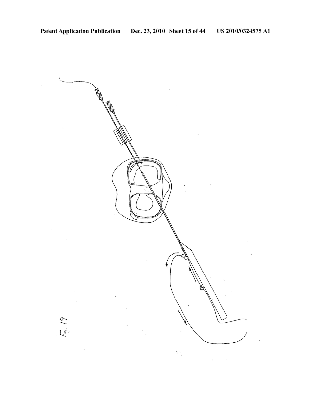 SURGICAL REPAIR KIT AND ITS METHOD OF USE - diagram, schematic, and image 16