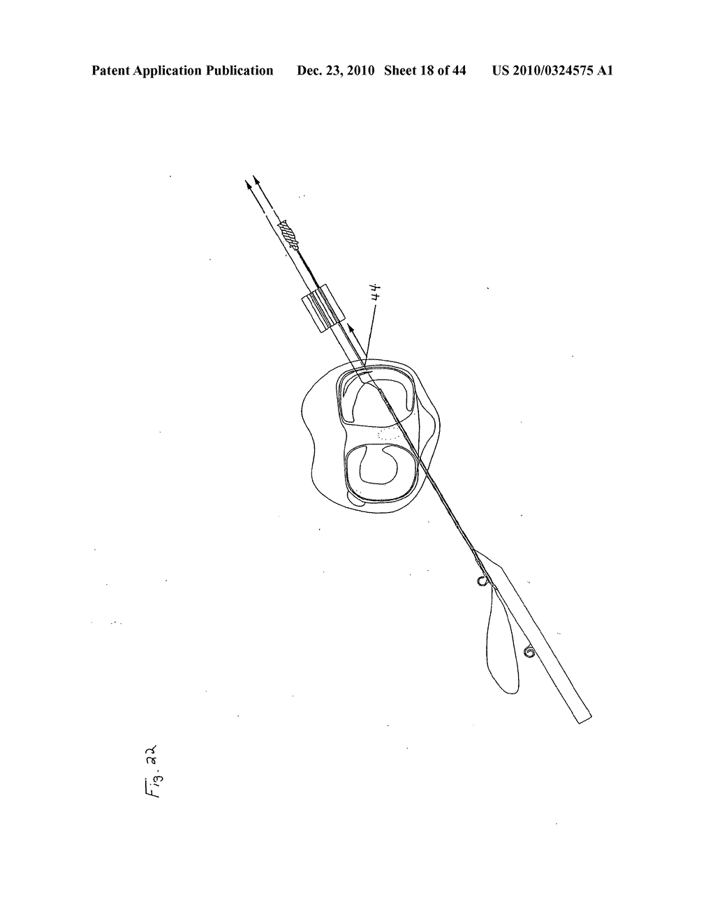 SURGICAL REPAIR KIT AND ITS METHOD OF USE - diagram, schematic, and image 19