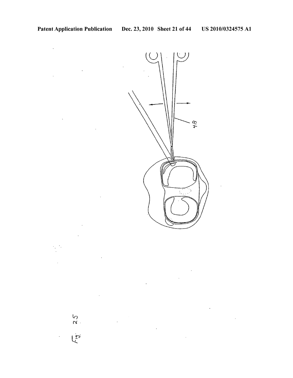 SURGICAL REPAIR KIT AND ITS METHOD OF USE - diagram, schematic, and image 22