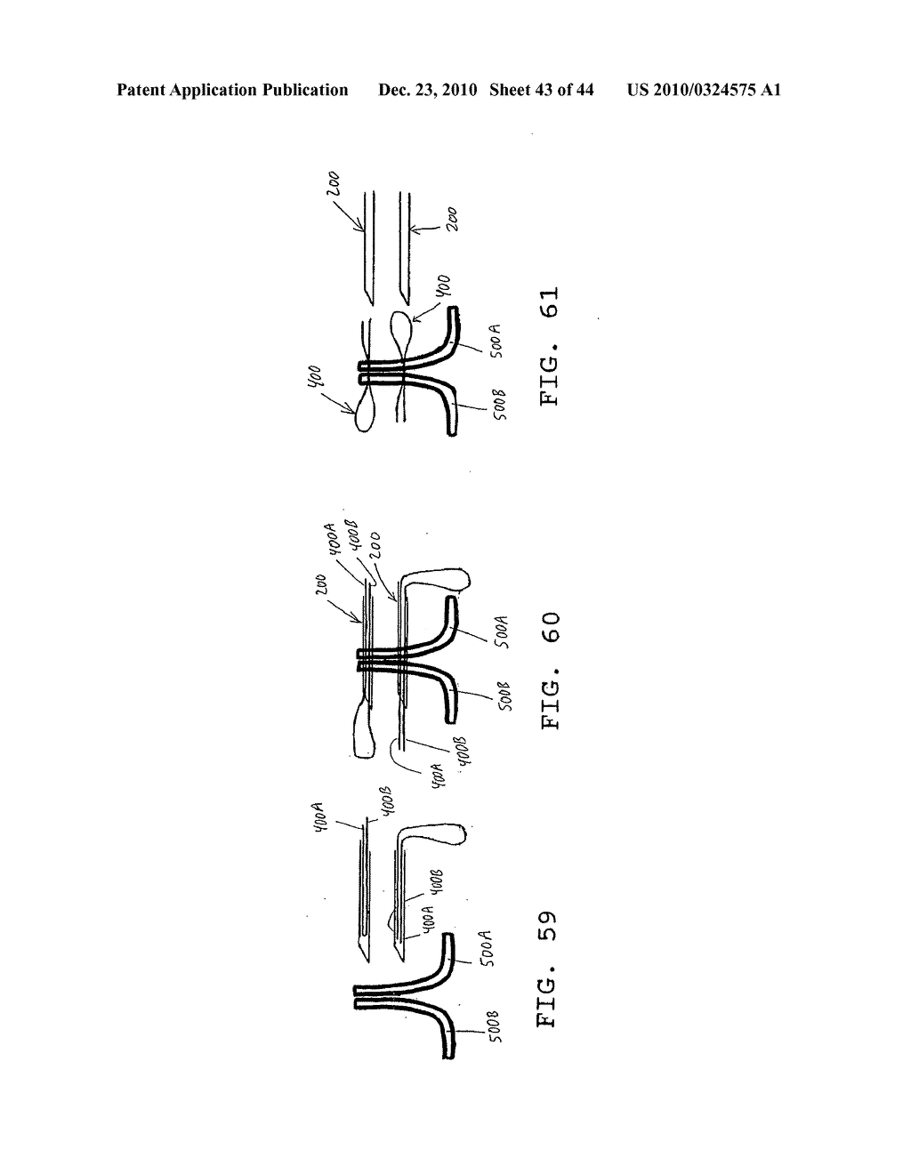 SURGICAL REPAIR KIT AND ITS METHOD OF USE - diagram, schematic, and image 44