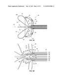 MEDICAL DEVICE FOR MODIFICATION OF LEFT ATRIAL APPENDAGE AND RELATED SYSTEMS AND METHODS diagram and image