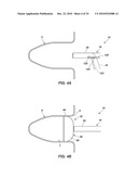 MEDICAL DEVICE FOR MODIFICATION OF LEFT ATRIAL APPENDAGE AND RELATED SYSTEMS AND METHODS diagram and image