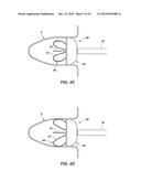 MEDICAL DEVICE FOR MODIFICATION OF LEFT ATRIAL APPENDAGE AND RELATED SYSTEMS AND METHODS diagram and image