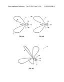 MEDICAL DEVICE FOR MODIFICATION OF LEFT ATRIAL APPENDAGE AND RELATED SYSTEMS AND METHODS diagram and image