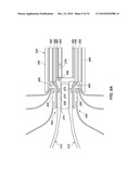 MEDICAL DEVICE FOR MODIFICATION OF LEFT ATRIAL APPENDAGE AND RELATED SYSTEMS AND METHODS diagram and image