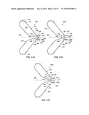 MEDICAL DEVICE FOR MODIFICATION OF LEFT ATRIAL APPENDAGE AND RELATED SYSTEMS AND METHODS diagram and image