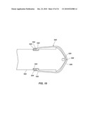 MEDICAL DEVICE FOR MODIFICATION OF LEFT ATRIAL APPENDAGE AND RELATED SYSTEMS AND METHODS diagram and image