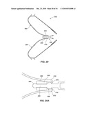 MEDICAL DEVICE FOR MODIFICATION OF LEFT ATRIAL APPENDAGE AND RELATED SYSTEMS AND METHODS diagram and image