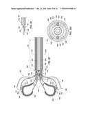 MEDICAL DEVICE FOR MODIFICATION OF LEFT ATRIAL APPENDAGE AND RELATED SYSTEMS AND METHODS diagram and image