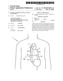 BLOOD CLOT REMOVAL DEVICE, SYSTEM, AND METHOD diagram and image