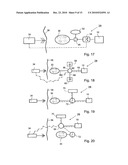 BLOOD CLOT REMOVAL DEVICE, SYSTEM, AND METHOD diagram and image