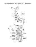 SYSTEM FOR RIB FIXATION diagram and image
