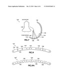 SYSTEM FOR RIB FIXATION diagram and image