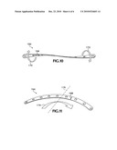 SYSTEM FOR RIB FIXATION diagram and image