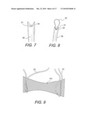 GRAFT PROTECTION MESH AND FIXATION TECHNIQUE diagram and image