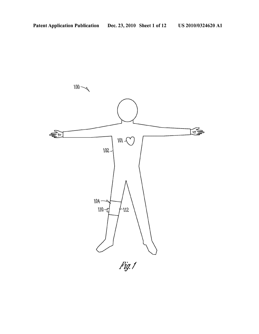 PERCUTANEOUS NEUROSTIMULATOR FOR MODULATING CARDIOVASCULAR FUNCTION - diagram, schematic, and image 02