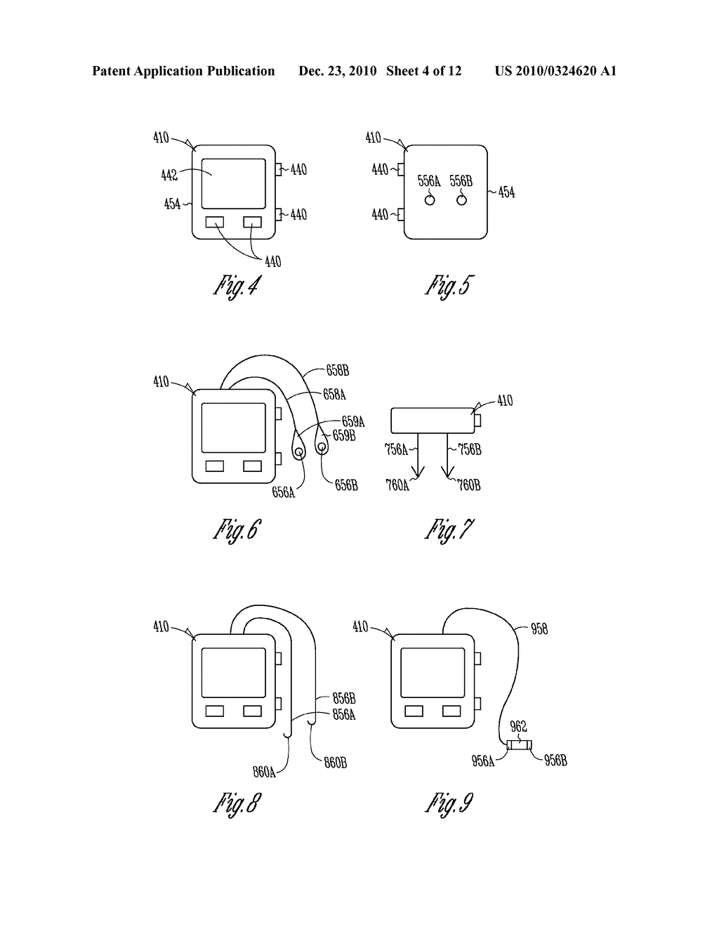 PERCUTANEOUS NEUROSTIMULATOR FOR MODULATING CARDIOVASCULAR FUNCTION - diagram, schematic, and image 05