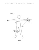 PERCUTANEOUS NEUROSTIMULATOR FOR MODULATING CARDIOVASCULAR FUNCTION diagram and image