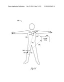 TRANSCUTANEOUS NEUROSTIMULATOR FOR MODULATING CARDIOVASCULAR FUNCTION diagram and image