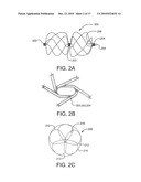 Sealing Device and Delivery System diagram and image