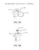 Sealing Device and Delivery System diagram and image