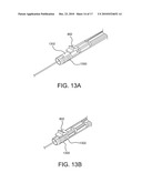 Sealing Device and Delivery System diagram and image