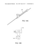 Sealing Device and Delivery System diagram and image